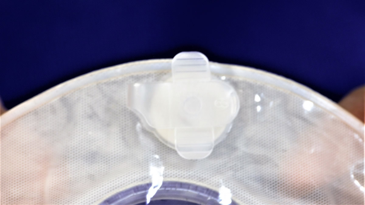 Close the vent and your colostomy or ileostomy bag with attached Osto-EZ-Vent is ready to use!